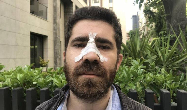 Aile hekimine pusu: 'Rapor vermezsin öyle mi?' diyerek saldırdılar