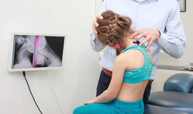 Her 100 çocuktan 3’ünde nedeni bilinmeyen skolyoz görülüyor