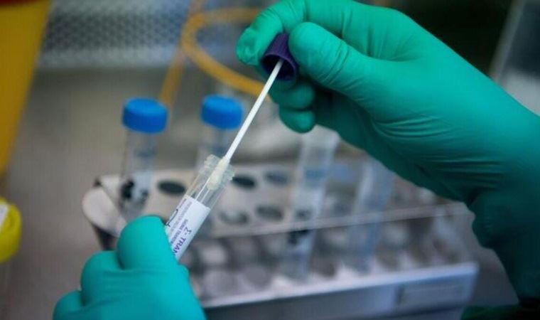 İsveç'te yaklaşık 100 bin kişiye sahte PCR testi satıldığı iddiasıyla inceleme başlatıldı