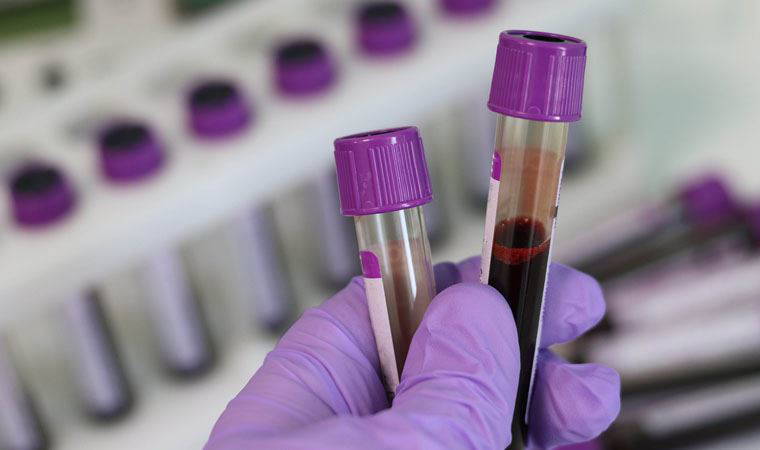 50 kanser türünü doğru tespit eden kan testi kullanıma uygun bulundu