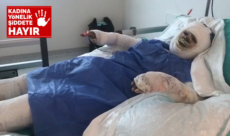 Kayınvalidesinin üzerine benzin döküp ateşe verdi