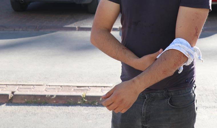 Kurban kesim kazaları uzuv kayıplarına yol açabiliyor