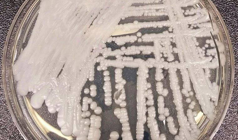 ABD'de ilaçlara karşı dirençli süper mantar yayılıyor