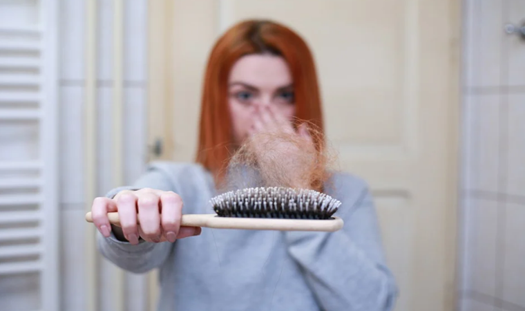 Günde 100 telin üzerinde saç dökülmelerinde önlem şart