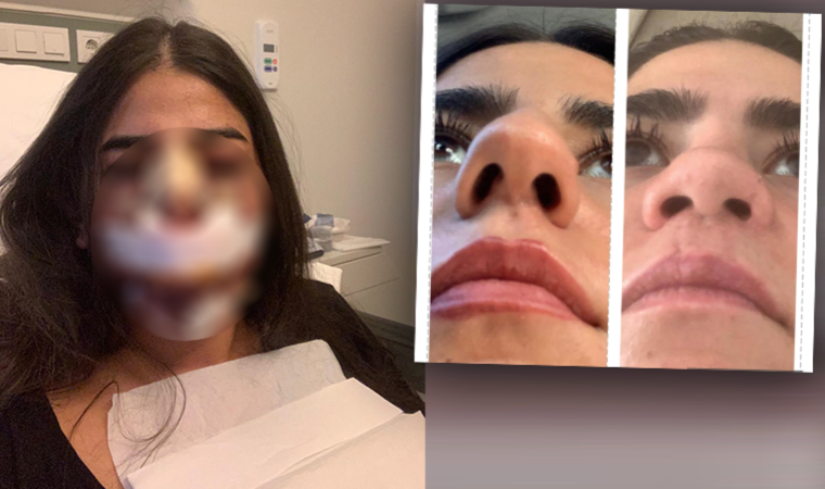 Avusturya'dan İstanbul'a gelen genç kadına evlilik öncesi estetik şoku