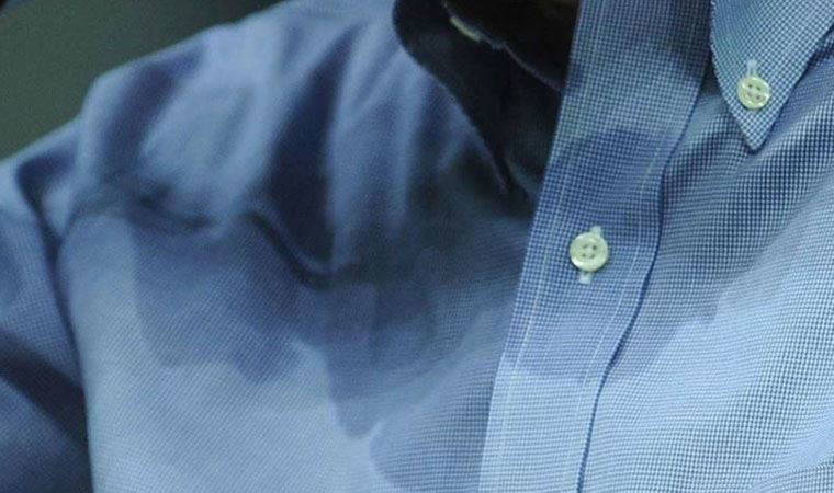 Uzmanı uyardı: Bölgesel aşırı terleme ameliyat sebebi olabilir