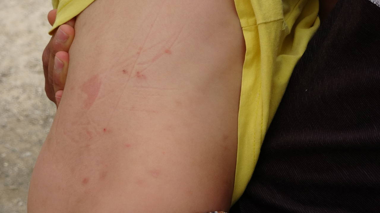 İstanbul'da görülen Asya kaplan sivrisineği 'yerleşik türler' arasına girdi