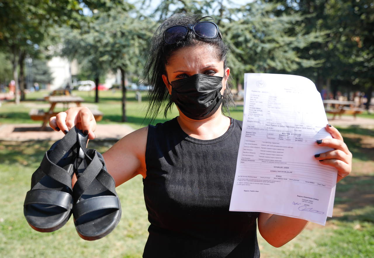 Ayaklarında yara oluşan kadının 