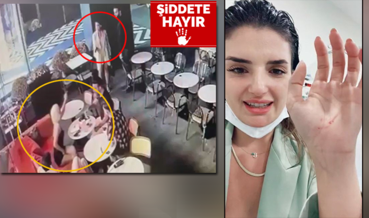 Begüm Polat’a saldırı anı kamerada