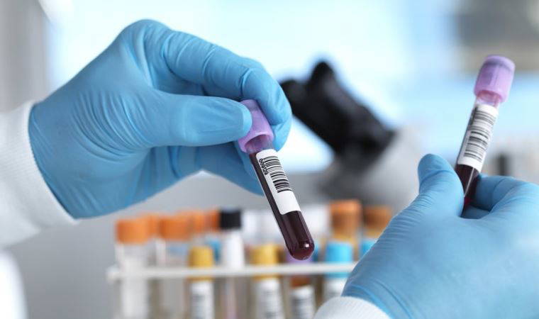 Kanser: İngiltere'de 50'den fazla kanser türünü erken teşhis etmesi umulan kan testi deneniyor