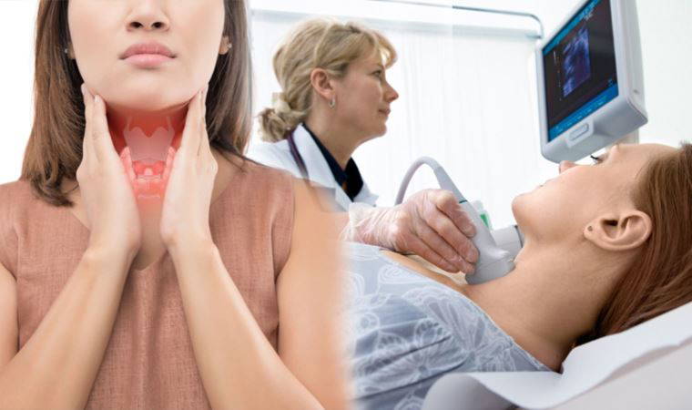 Tiroid kanserinin görülme sıklığı yüzde 185 arttı: Türkiye'nin 2 bölgesinde daha şiddetli