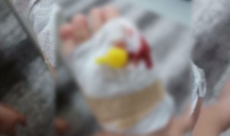 Hemofili hastası çocuklar, deri altına uygulanan ilacın SGK tarafından karşılanmasını bekliyor