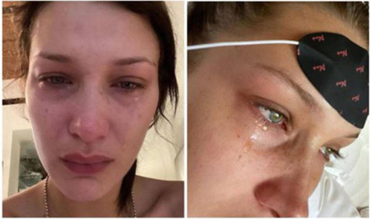 Bella Hadid, 'depresyon' fotoğraflarını savundu: 'Gerçeğim hakkında konuşabilmek iyi geldi'