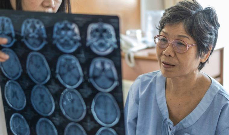 Demans araştırması: Dünyada vakalar 2050'ye kadar üçe katlanarak 153 milyona çıkabilir