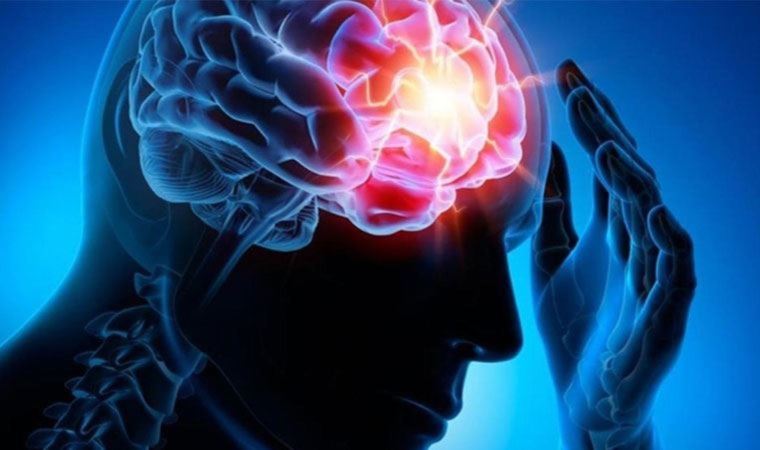 Uzmanı anlattı: Akıllı epilepsi piliyle nöbetler durdurulabilir