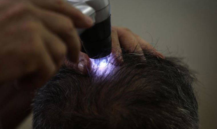 Saç uzmanları uyardı! Saç kaybı ve kellik psikolojiyi etkiliyor