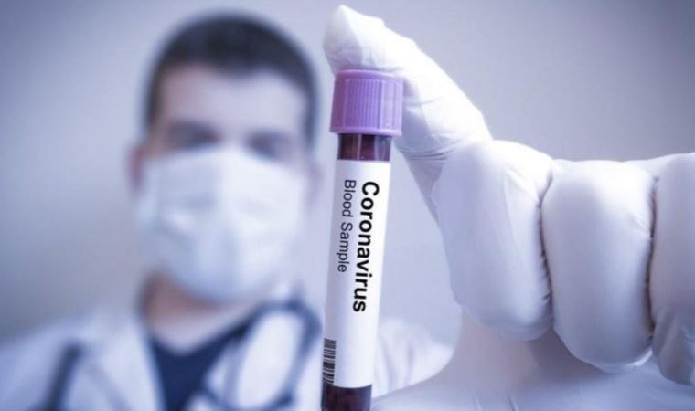 Covid-19'a yaklananlarla ilgili çarpıcı araştırma: Riski yüzde 60 artırabiliyor