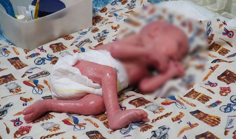 300 milyonda bir görülen hastalığa yakalanan bebek 1 yaşında: 'Oğlumu öpmemiz yasak'