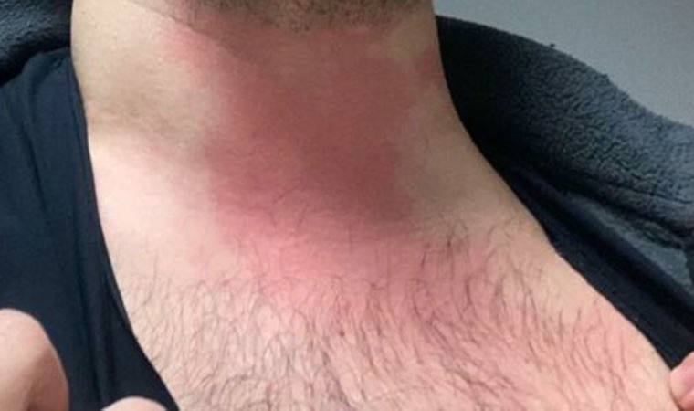 Uzman çavuş şiddeti: 14 Mart Tıp Bayramı'nda doktoru darbetti (15 Mart 2022)