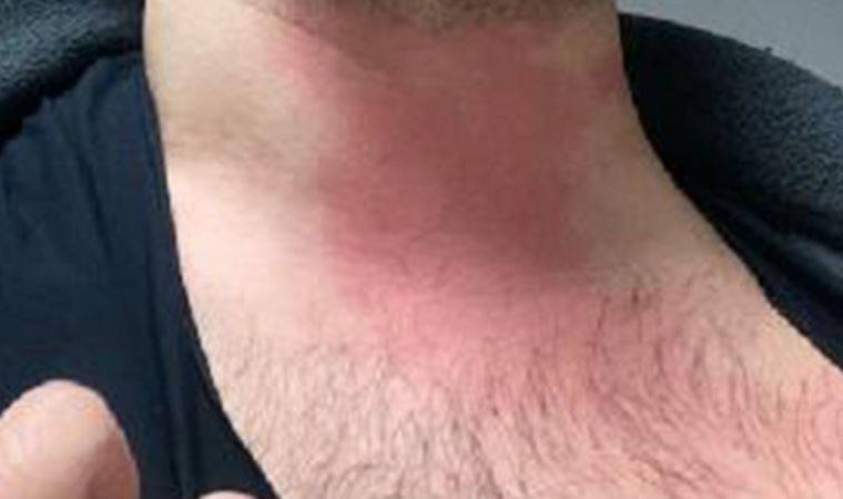 Uzman çavuş şiddeti: 14 Mart Tıp Bayramı'nda doktoru darbetti (15 Mart 2022) (Video Haber)