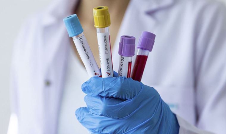 Trabzonspor'da 1 pozitif vaka