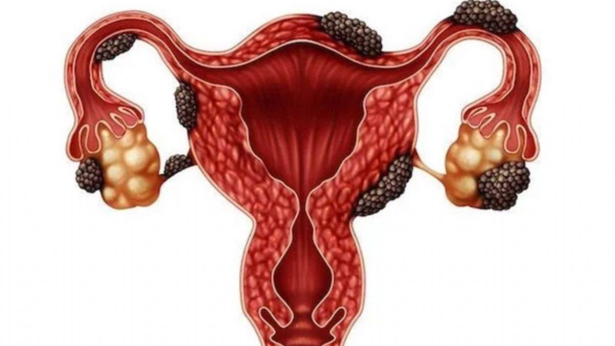 Adet döneminde normaldir demeyin! Özellikle 3 belirtisine dikkat!