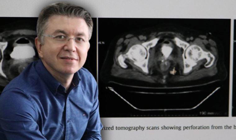 Makatına torpil yerleştirip patlatan vakayı inceleyen doktor anlattı: İlk gördüğümüzde çok şaşırdık