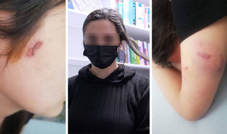 Konya'da 'şehri terk edeceksin' tehdidiyle işkence: İkinci şikayet üzerine tutuklandılar (13 Nisan 2022)