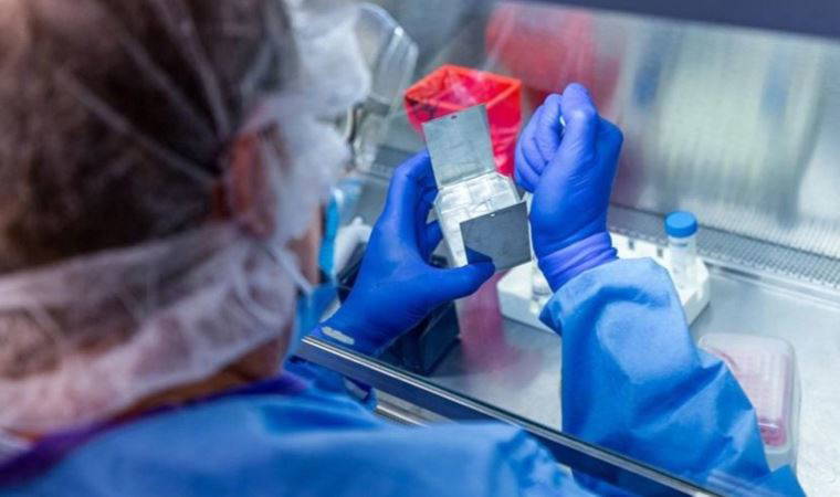 Bilim insanları dışkıları inceledi: Aylar sonra bile covid çıktı