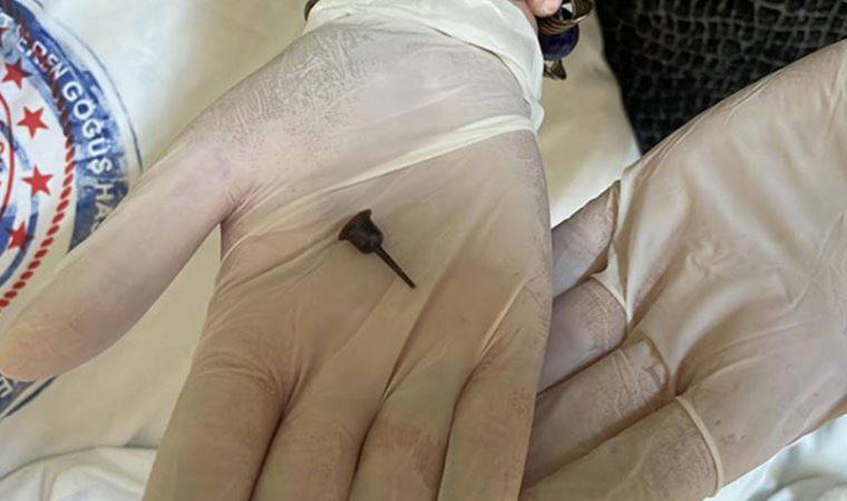 Nefes darlığı şikayetiyle gitti,  9 yıl boyunca mum tutacağıyla yaşadığı ortaya çıktı