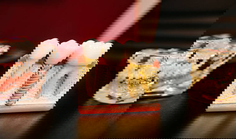 Ağız ve diş bakımı nasıl olmalı? İşte önemli ayrıntılar