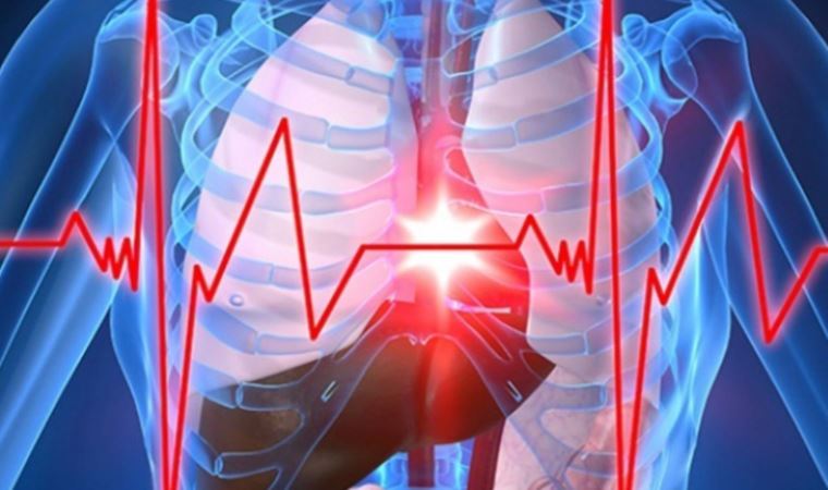 Sinsi ve ölümcül: 'Aort anevrizması'