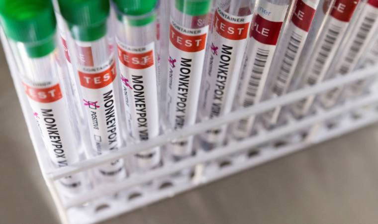 İspanya'da çoğu Madrid'de 40 kesin, 52 şüpheli maymun çiçeği vakası var