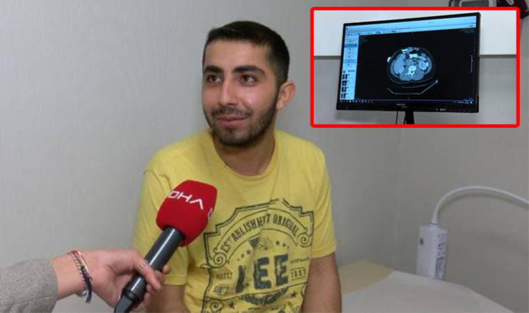 40 santimetrelik fıtıkla yaşıyordu; yeni cihazla iyileşti