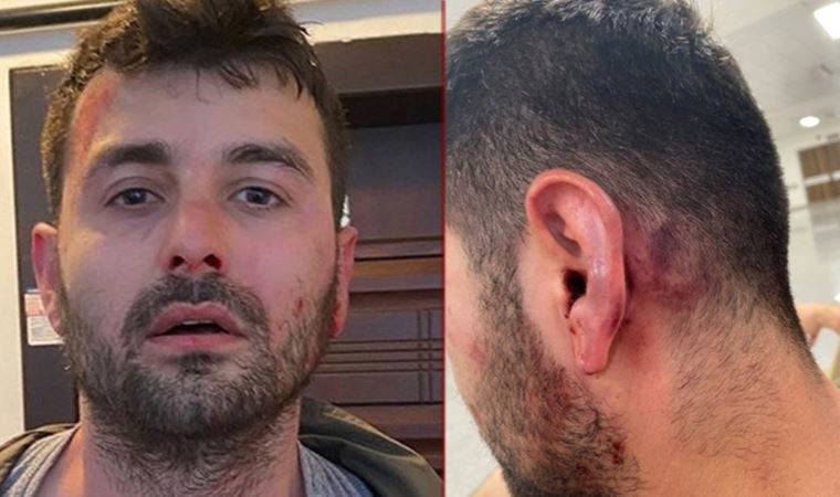 Ünlü futbolcunun kardeşi...