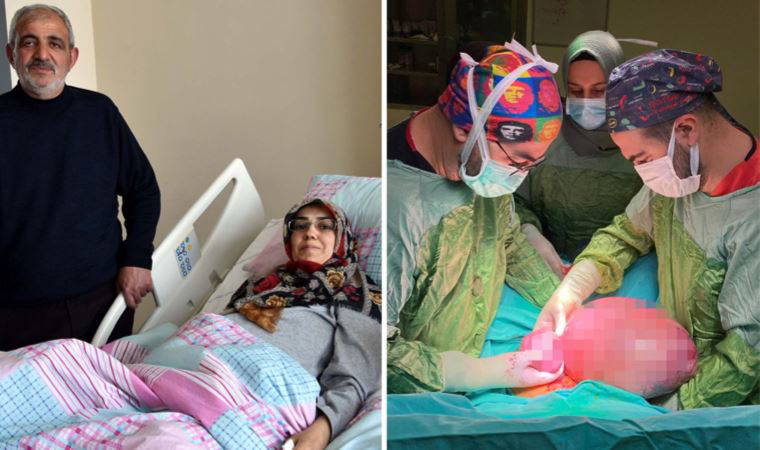 Karnını kaplayan kitle operasyonla çıkartıldı, doktorlar bile şaşırdı: 'Çok nadir görüyoruz'