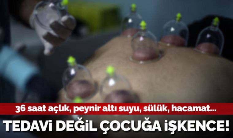 Alternatif tıp adıyla çocuğunu 15 günde bir 36 saat aç bırakıyor