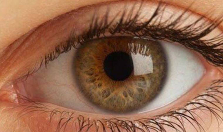 Göz ağrınızın nedenleri çok çeşitli olabilir! Sinüzit ve baş ağrısına dikkat