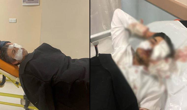 Sivas Ziraat Odası Genel Sekreteri saldırıda ağır yaralandı