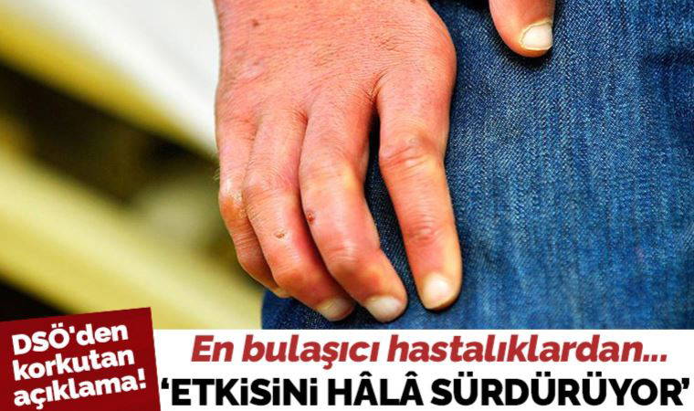 DSÖ'den korkutan açıklama: Tarihin en eski bulaşıcı hastalıklarından cüzzam hala etkisini sürdürüyor