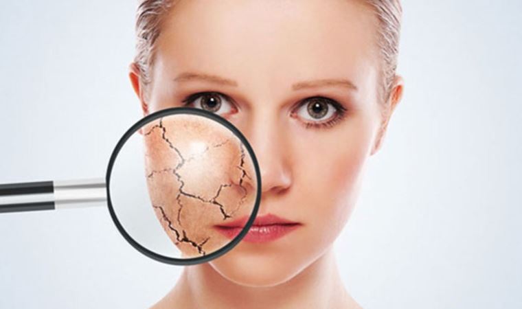 Kış aylarında 'cilt sağlığını' koruma önerileri (31 Ocak 2023)