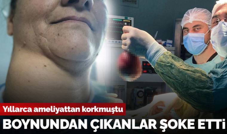 Yıllarca ameliyattan korkan hasta ikna edildi, boynundan çıkanlar şoke etti
