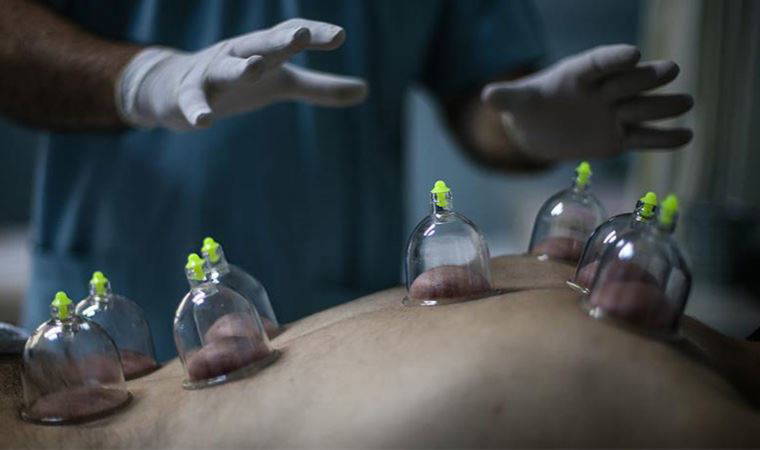 Yurttaşı 'hacamat'a yönlendiriyorlar...