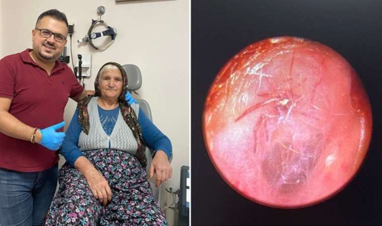 ‘Hışırtı’ şikayetiyle gitti: Kulağından canlı örümcek çıktı!