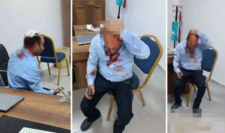 Şanlıurfa'da okul müdürü 'demir sopalı' saldırıya uğradı