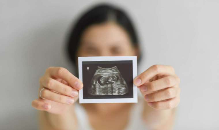 Kadınlar dikkat: Bu yaştan sonra yumurtalıkların yüzde 90’ı tükeniyor