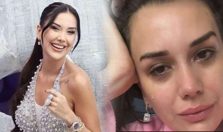 Gözyaşları içinde açıkladı: Dilan Polat, tedavisi olmayan Lupus (Kelebek) hastalığına yakalandı