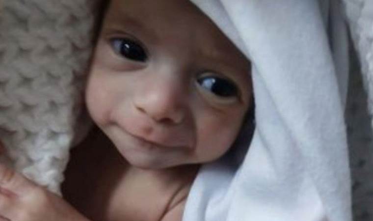 'Hala yaşıyor olmaları bir mucize'