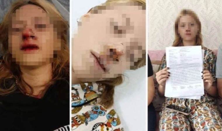 Lise öğrencisine taşla saldırmıştı: Tahliye edildi!