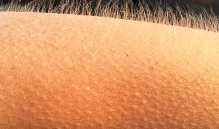 Bazıları tüylerinin diken diken olmasını nasıl kontrol ediyor?